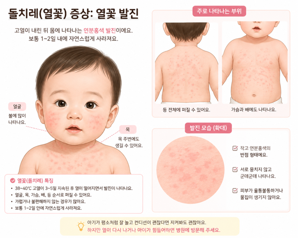 열꽃 발진 모습